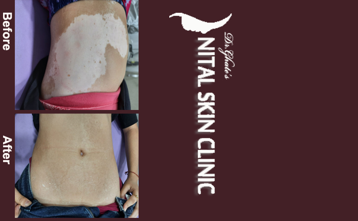 skin specialist in pune