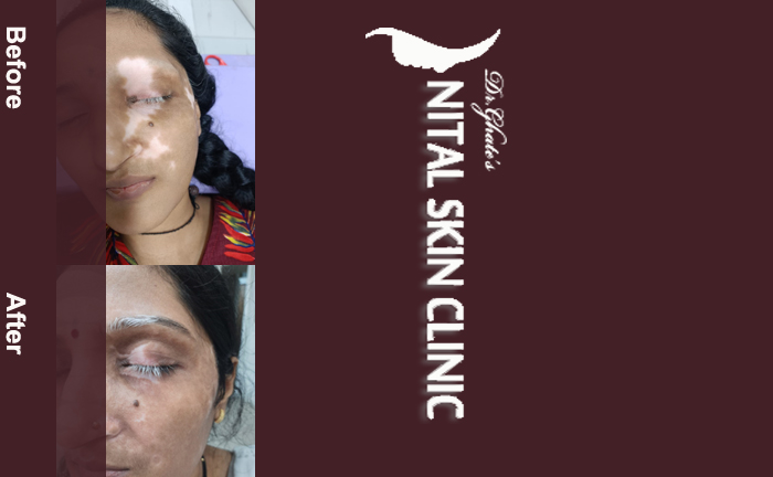 skin specialist in pune