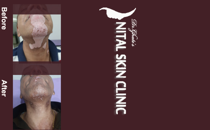 skin specialist in pune