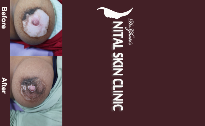 skin specialist in pune