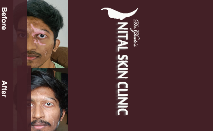 skin specialist in pune