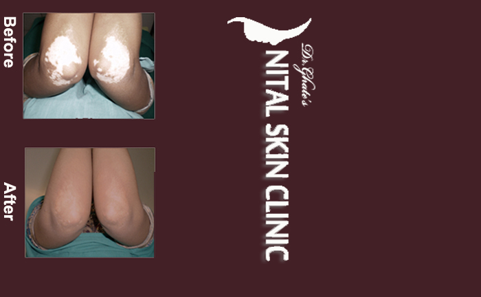 skin specialist in pune