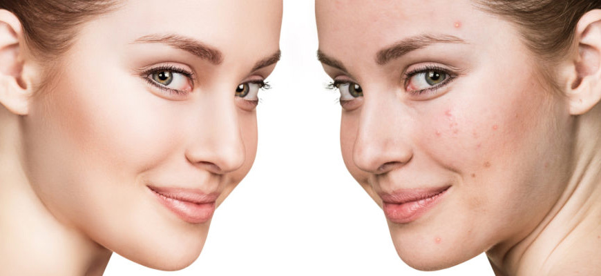 skin specialist in pune