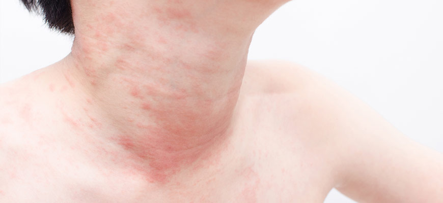 skin specialist in pune